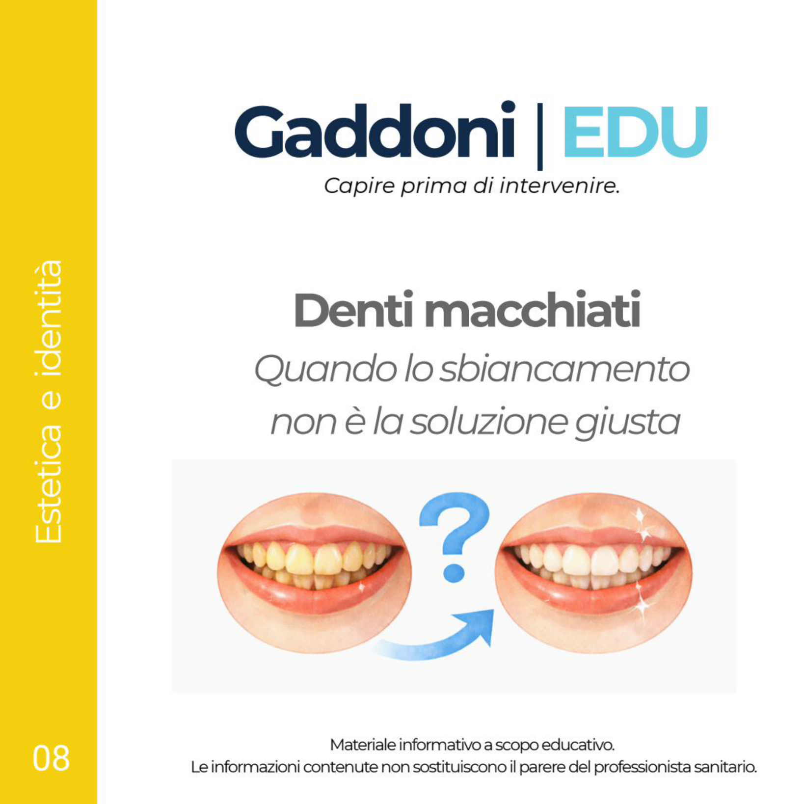 Copertina Denti macchiati