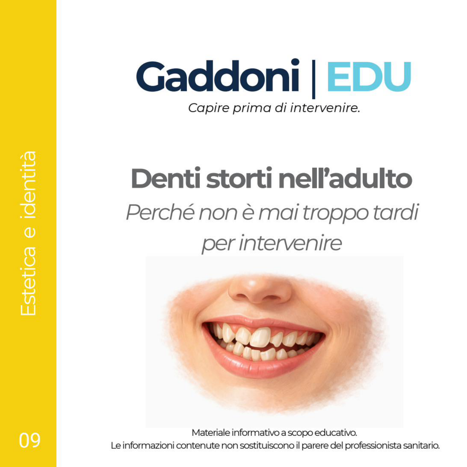 Copertina Denti storti nell’adulto