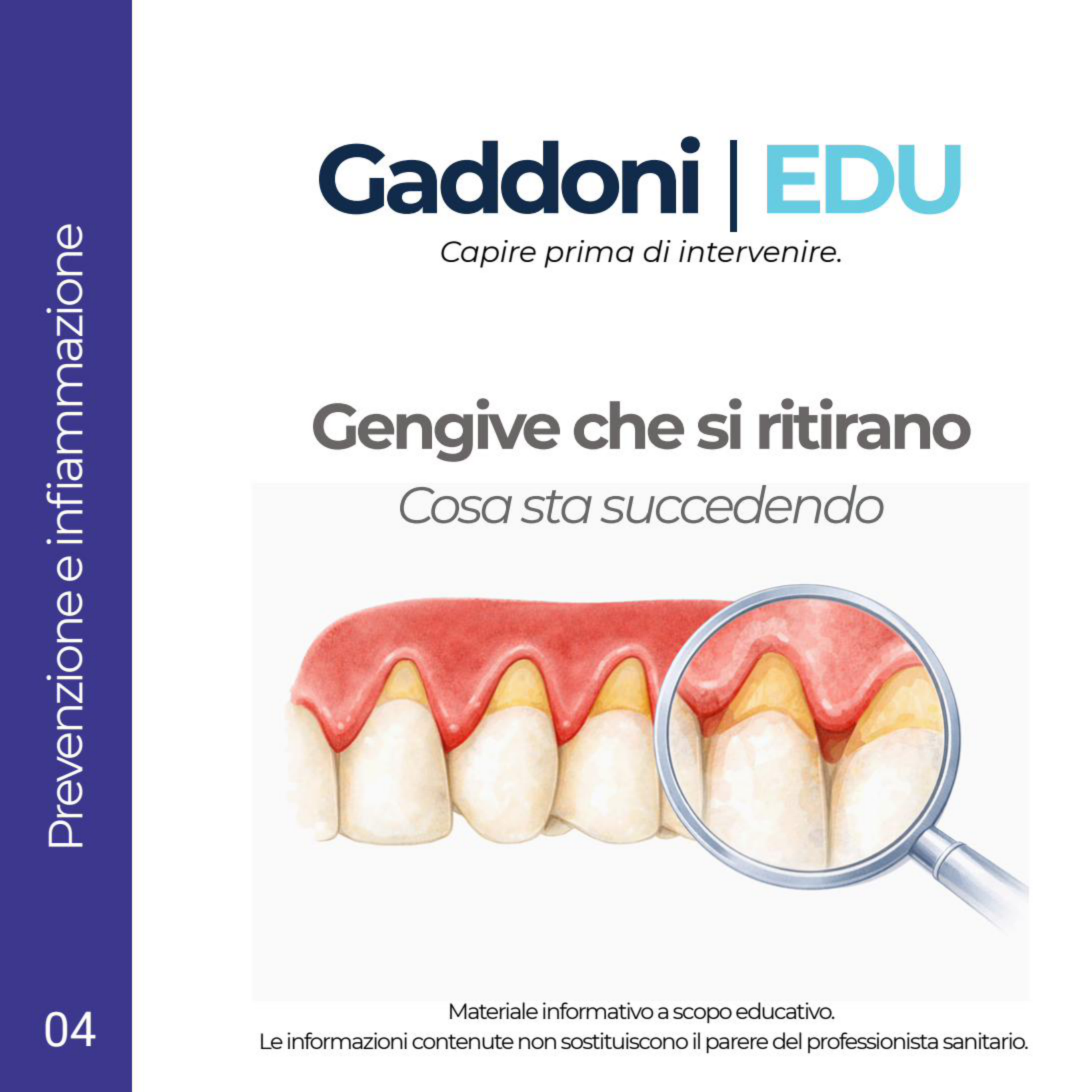 Copertina Gengive che si ritirano
